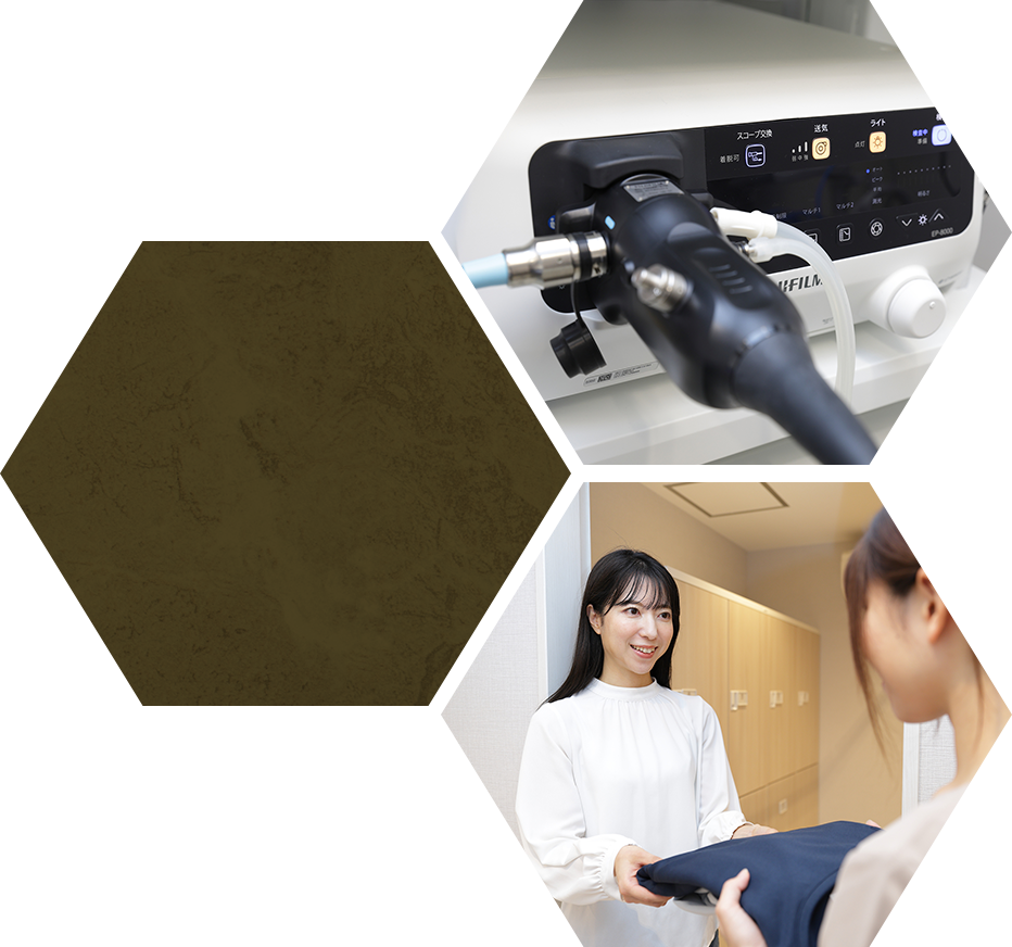 胃カメラ検査（胃内視鏡検査）