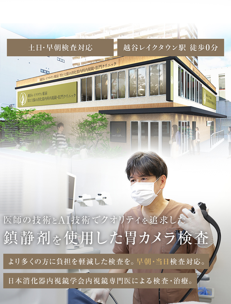土日・早朝検査対応 越谷レイクタウン駅 徒歩0分 医師の技術とAI技術でクオリティを追求した鎮静剤を使用した胃カメラ検査 より多くの方に負担を軽減した検査を。早朝・当日検査対応。 日本消化器内視鏡学会内視鏡専門医による検査・治療。